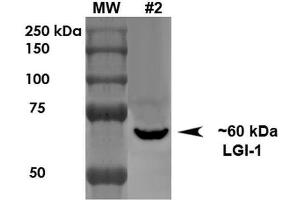 Western Blot analysis of Rat Brain Membrane showing detection of ~60 kDa LGI1 protein using Mouse Anti-LGI1 Monoclonal Antibody, Clone S283-7 . (LGI1 抗体  (AA 37-113) (Atto 594))
