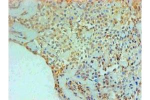 Immunohistochemical of paraffin-embedded Human Breast tissue using ABIN7166415 at dilution of 1:200. (Transglutaminase 2 抗体)
