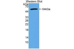 Detection of Recombinant CTRB2, Human using Polyclonal Antibody to Chymotrypsinogen B2 (CTRB2) (CTRB2 抗体  (AA 34-263))