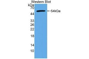 Detection of Recombinant CTRB2, Human using Polyclonal Antibody to Chymotrypsinogen B2 (CTRB2) (CTRB2 抗体  (AA 34-263))