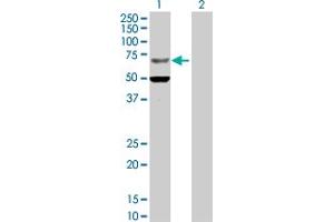 Western Blot analysis of ZNF182 expression in transfected 293T cell line by ZNF182 MaxPab polyclonal antibody. (ZNF182 抗体  (AA 1-620))
