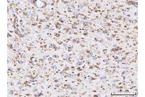 IHC analysis of RBP1 using anti-RBP1 antibody (ABIN7599586). (RBP1 抗体  (AA 10-135))