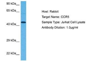 Host: Rabbit Target Name: CCR5 Sample Tissue: Human Jurkat Whole Cell Antibody Dilution: 1ug/ml (CCR5 抗体  (Middle Region))