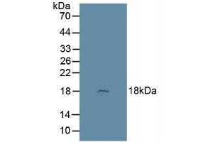 Figure. (Adrenomedullin 抗体  (AA 22-147))