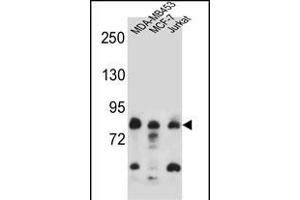 AFG3L2 Antibody (N-term) (ABIN657143 and ABIN2846279) western blot analysis in MDA-M,MCF-7,Jurkat cell line lysates (35 μg/lane). (AFG3L2 抗体  (N-Term))