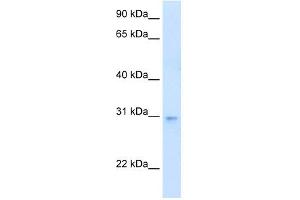 WB Suggested Anti-LDB3 Antibody Titration:  0. (LIM Domain Binding 3 Protein 抗体  (N-Term))