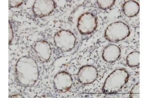 Immunoperoxidase of monoclonal antibody to CHEK2 on formalin-fixed paraffin-embedded human colon. (CHEK2 抗体  (AA 1-543))