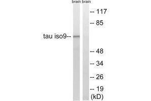 Western blot analysis of extracts from rat brain cells, using Tau (Ab-534/217) antibody. (MAPT 抗体  (Thr217, Thr534))