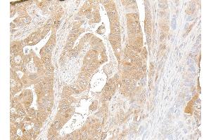 Immunohistochemistry (IHC) image for anti-NF-KappaB2 (/p52) (AA 1-50) antibody (ABIN7795782) (Recombinant NF-KappaB2 (/p52) (AA 1-50) 抗体)