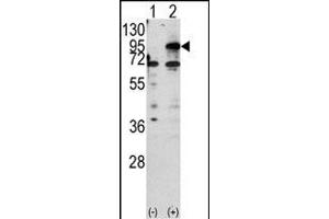 Western blot analysis of CPT1B (arrow) using rabbit polyclonal CPT1B Antibody (C-term) (ABIN389106 and ABIN2839296). (CPT1B 抗体  (C-Term))