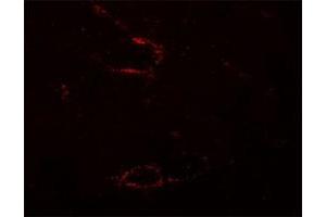 Immunofluorescencent staining of mouse skeletal muscle cells with SYNPO2L polyclonal antibody  at 5 ug/mL. (SYNPO2L 抗体  (N-Term))