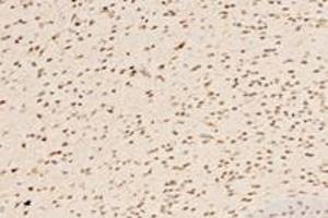Immunohistochemistry analysis of paraffin-embedded mouse striatum using,IRX1 (ABIN7074377) at dilution of 1: 4400 (IRX1 抗体)