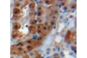 Used in DAB staining on fromalin fixed paraffin-embedded Kidney tissue (Calreticulin 抗体  (AA 18-193))