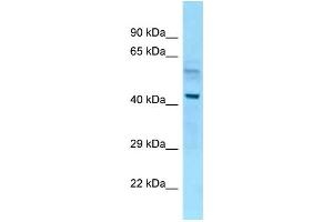 WB Suggested Anti-Nap1l4 Antibody Titration: 1. (NAP1L4 抗体  (N-Term))