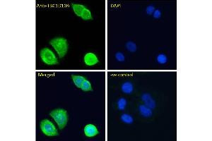 ABIN6391415 Immunofluorescence analysis of paraformaldehyde fixed MCF7 cells, permeabilized with 0. (TBC1D10A 抗体  (N-Term))