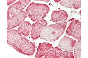 Immunohistochemistry (IHC) image for anti-Sema Domain, Immunoglobulin Domain (Ig), Transmembrane Domain (TM) and Short Cytoplasmic Domain, (Semaphorin) 4D (SEMA4D) (AA 812-862) antibody (ABIN2627974)