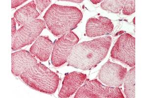 Human Skeletal Muscle: Formalin-Fixed, Paraffin-Embedded (FFPE) (SEMA4D/CD100 抗体  (AA 812-862))