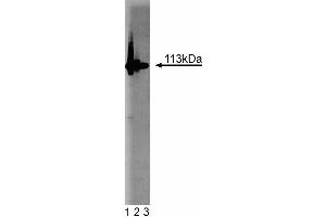 Western blot analysis of PARP on Jurkat cell lysate. (PARP1 抗体  (AA 22-219))