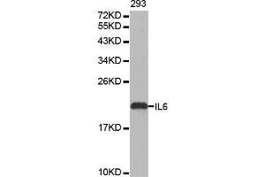 Western blot analysis of extracts of 293 cell line, using IL6 antibody. (IL-6 抗体)