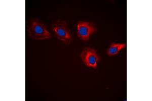 Immunofluorescent analysis of MARK3 staining in HeLa cells. (MARK3 抗体  (N-Term))