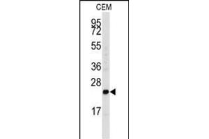 Western blot analysis of anti-FGF4 Antibody (C-term) (ABIN392776 and ABIN2842218) in CEM cell line lysates (35 μg/lane). (FGF4 抗体  (C-Term))