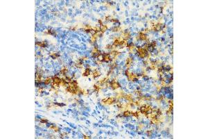 Immunohistochemistry of paraffin-embedded rat spleen using CD3D antibody (ABIN5970580) at dilution of 1/200 (40x lens). (CD3D 抗体)