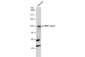 WB Image HNF1 alpha antibody [N1N3] detects HNF1 alpha protein by western blot analysis.