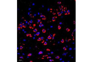 Immunofluorescence of paraffin embedded mouse brain using P4H (ABIN7074215) at dilution of 1:700 (400x lens) (HIF Prolyl Hydroxylase 抗体)