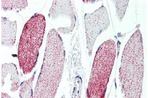 Human Skeletal Muscle (formalin-fixed, paraffin-embedded) stained with ACO2 antibody ABIN462115 followed by biotinylated goat anti-rabbit IgG secondary antibody ABIN481713, alkaline phosphatase-streptavidin and chromogen. (ACO2 抗体  (AA 438-467))