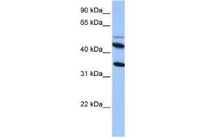 IL13RA2 antibody used at 1 ug/ml to detect target protein. (IL13RA2 抗体  (Middle Region))