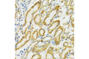 Immunohistochemistry of paraffin-embedded rat kidney using HSPA9 antibody. (HSPA9 抗体  (AA 380-679))