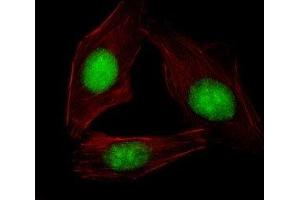 Immunofluorescence (IF) image for anti-Sterol Regulatory Element Binding Transcription Factor 2 (SREBF2) (AA 399-427) antibody (ABIN3032752)