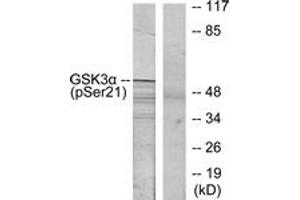 Western blot analysis of extracts from ovary cancer, using GSK3 alpha (Phospho-Ser21) Antibody. (GSK3 alpha 抗体  (AA 10-59))