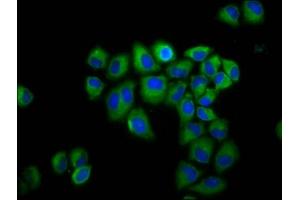 Immunofluorescence staining of Hela cells with ABIN7154190 at 1:200, counter-stained with DAPI. (GLRB 抗体  (AA 355-472))