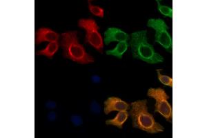 ABIN6265851 and ABIN6278192 staining Hela cells by IF/ICC.