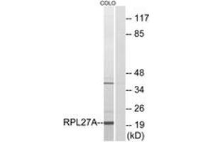 Western blot analysis of extracts from COLO cells, using RPL27A Antibody. (RPL27A 抗体  (AA 99-148))