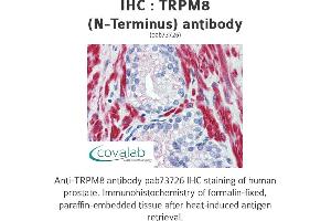 Image no. 2 for anti-Transient Receptor Potential Cation Channel, Subfamily M, Member 8 (TRPM8) (Cytoplasmic Domain), (N-Term) antibody (ABIN1740398)
