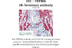 Image no. 2 for anti-Transient Receptor Potential Cation Channel, Subfamily M, Member 8 (TRPM8) (Cytoplasmic Domain), (N-Term) antibody (ABIN1740398) (TRPM8 抗体  (Cytoplasmic Domain, N-Term))