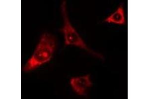 ABIN6275680 staining Hela cells by IF/ICC. (WIPF1 抗体  (C-Term))