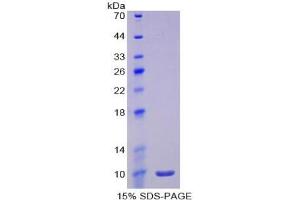 SDS-PAGE of Protein Standard from the Kit  (Highly purified E. (IL-6 Receptor ELISA 试剂盒)