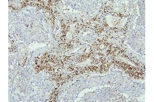 IHC analysis of SLC9A3R1 using anti-SLC9A3R1 antibody (ABIN6719642).