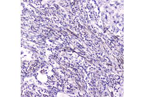 IHC analysis of CES1 using anti-CES1 antibody . (CES1 抗体  (AA 99-206))