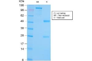 SDS-PAGE Analysis Purified GRP94 Recombinant Rabbit Monoclonal (HSP90B1/3168R). (Recombinant GRP94 抗体)