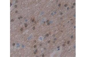 Used in DAB staining on fromalin fixed paraffin- embedded Kidney tissue (KHDRBS1 抗体  (AA 152-381))