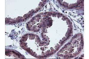 Immunohistochemical staining of paraffin-embedded Human breast tissue using anti-FGFR2 mouse monoclonal antibody. (FGFR2 抗体)