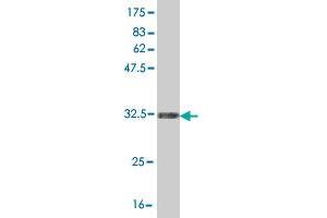 Western Blotting (WB) image for anti-Oculocerebrorenal Syndrome of Lowe (OCRL) (AA 146-239) antibody (ABIN518503)