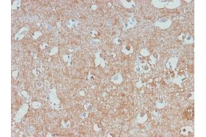 Formalin-fixed, paraffin-embedded human Cerebellum stained with Neurofilament Rabbit Monoclonal Antibody (NEFL/2983R). (Recombinant NEFL 抗体)