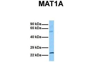 Host:  Rabbit  Target Name:  MAT1A  Sample Tissue:  Human Ovary Tumor  Antibody Dilution:  1. (MAT1A 抗体  (C-Term))