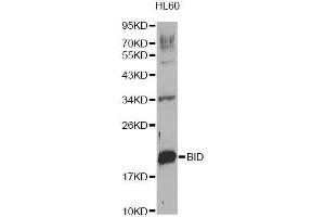 Western blot analysis of extracts of HL-60 cells, using BID Antibody. (BID 抗体  (AA 1-130))