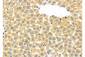 ABIN6260778 and ABIN6277329 at 1/100 staining Rat liver tissue by IHC-P. (CFHR1 抗体  (C-Term))